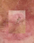 79_cancer-01kl.jpg